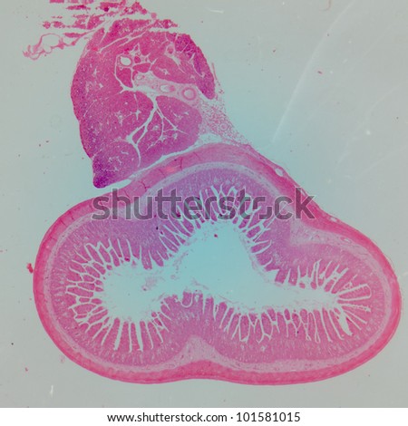 small intestinum tenue tissue micrograph