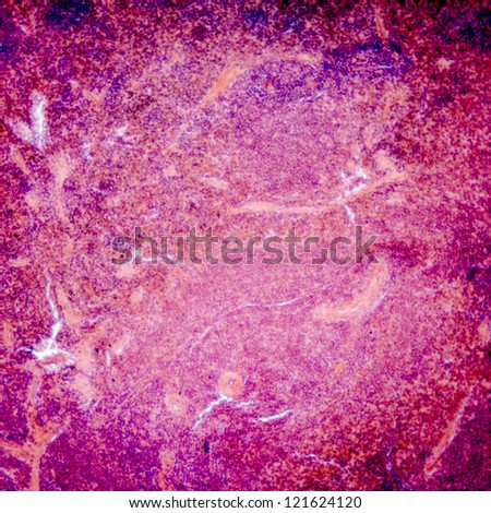 micrograph of pancreas tissue, typical pancreatic tissue  in the jejunum tissue