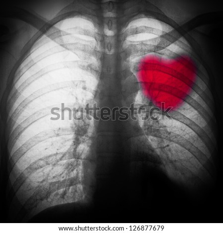x-ray of chest of human black and white with a red heart
