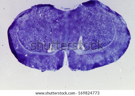 Micrograph of rat brain. Nervous physiology science cross section.