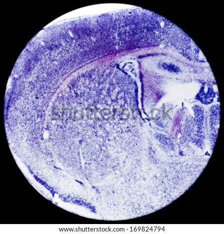 Micrograph of rat brain. Nervous physiology science cross section.
