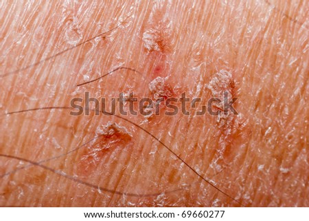 dry skin texture detail background