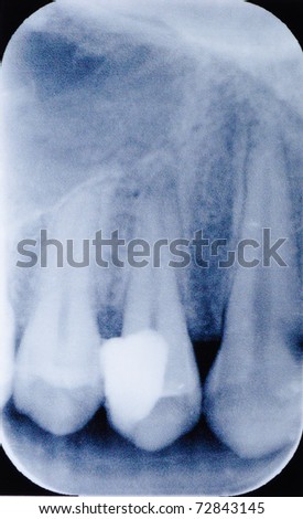 dental tooth x-ray film macro