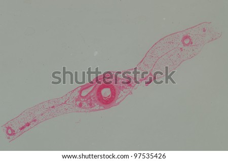 science medical anthropotomy physiology microscopic section of human artery vein tissue