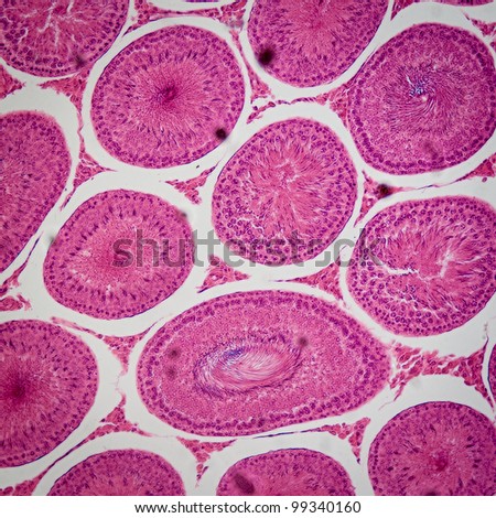 Ts Of Testis