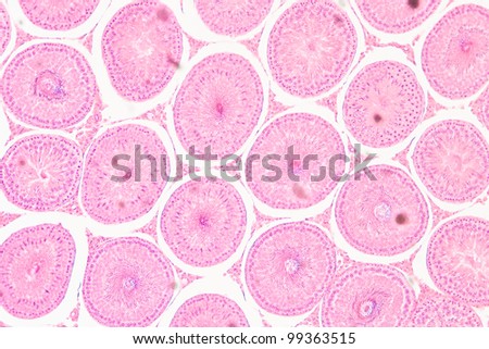 science medical anthropotomy physiology microscopic section of  Testis T.S tissue background