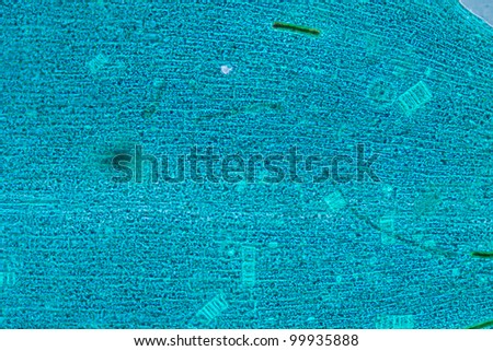 science microscopy micrograph black algae leaf Hydrilla verticillata micro