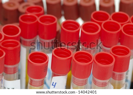 sample tubes
