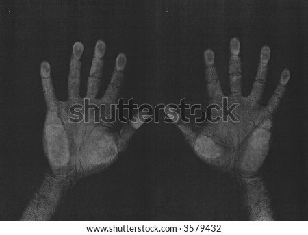 Photocopied hands, left and right