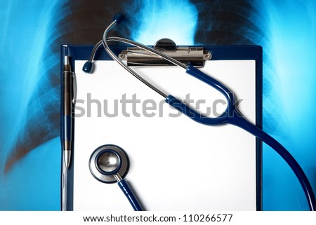Empty clipboard with X-ray photo and a stethoscope