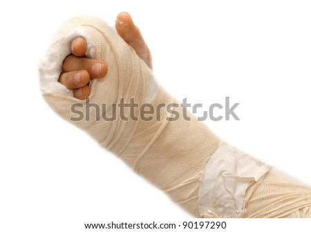 white arm cast