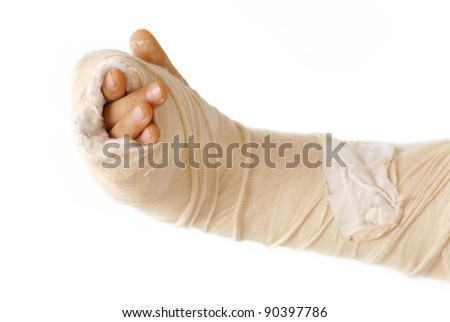 broken arm bone in a cast and bandages over white background isolated