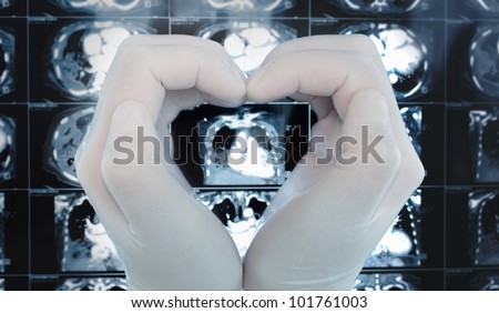 Hand make a heart embracing the image on the CT scan. Symbol profession in medicine, love of his work.