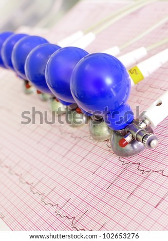 ECG electrodes with suction cups on the background of the electrocardiogram. Medical background. Closeup photography.