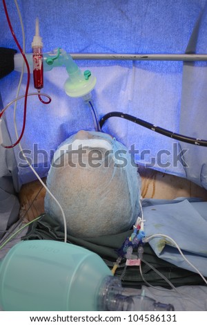Patient during endotracheal anesthesia. photo