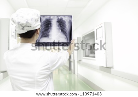 analysis X-ray of the chest. Woman doctor holding a chest X-ray in hospital ward.