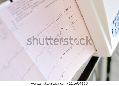 printing of electrocardiogram. photos