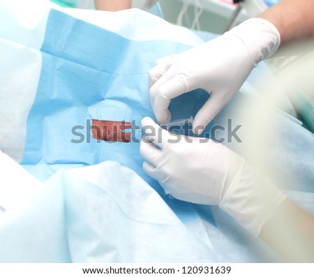 injection in a sterile environment