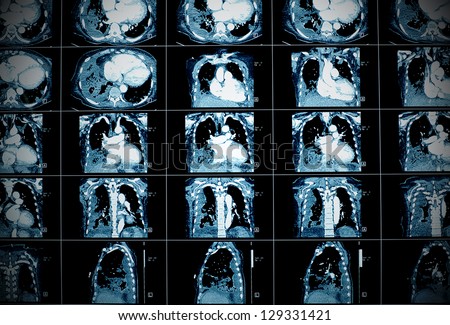 Medical background. CT scan