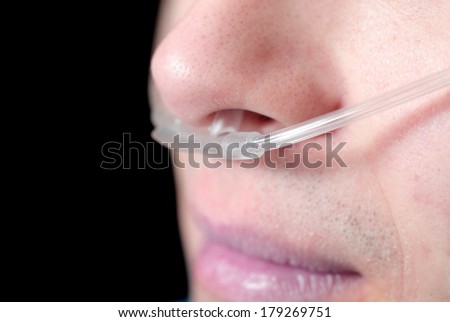 Oxygen tube on the face of the patient