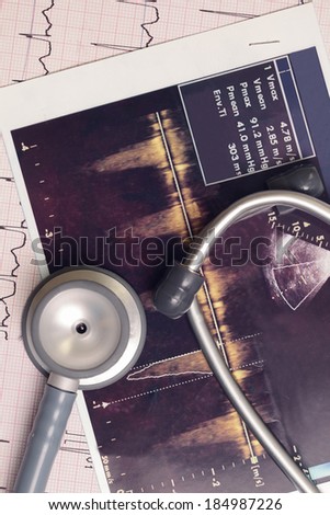 Stethoscope and medical records