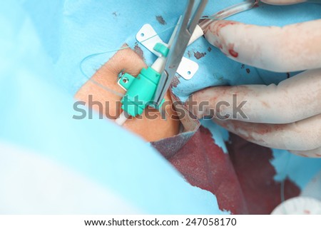 Close-up of the surgeon working with the patient