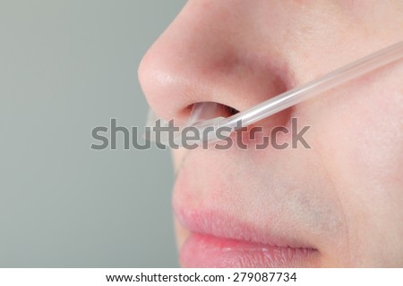 Oxygen tube in the patient\'s nose