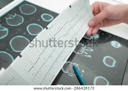 Doctors workplace table with medical documentation