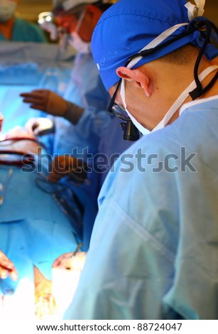 young surgeon in the magnifying glasses on the operation;