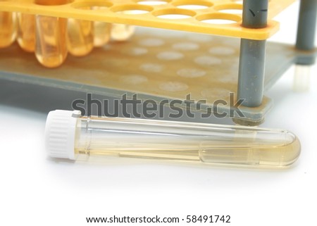 Yellow Fluid testing tube with rack