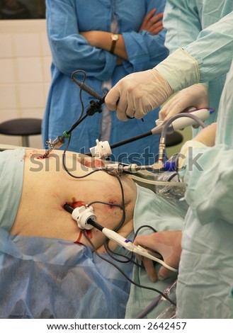 The nurse in a dark blue dressing gown observes a course of complex laparoscopic operation