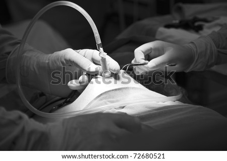 Preparation for the beginning of surgical operation with a cut
