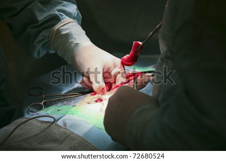 Hand of the surgeon are manipulated in the abdomen of patient