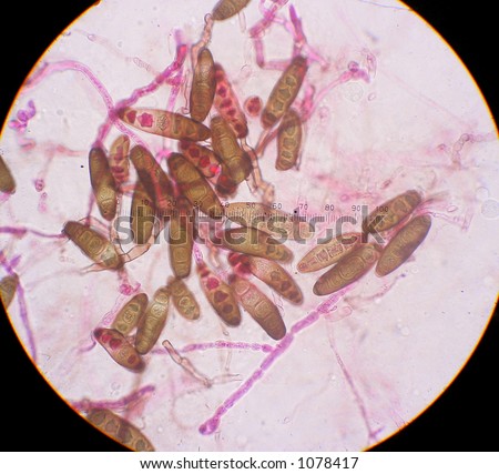 Fungal spores under the microscope (fungus causes a plant disease)