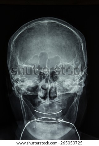 X-ray of head / Many others X-ray images in my portfolio