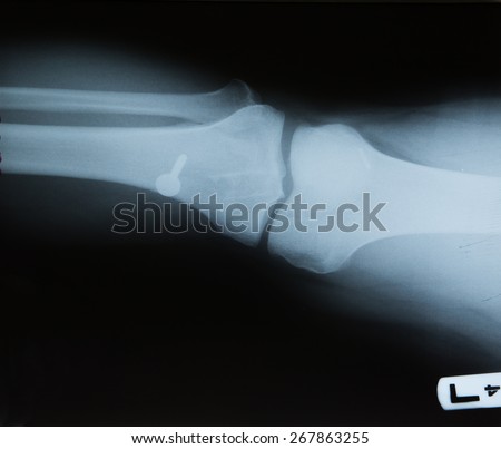 X-ray knee / Many others X-ray images in my portfolio