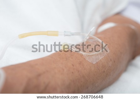 Left hand of the patient on clean bed in the hospital