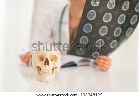 Closeup on human skull and medical doctor woman with fluorography in background