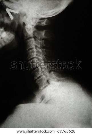 detail of neck and part of head x-ray