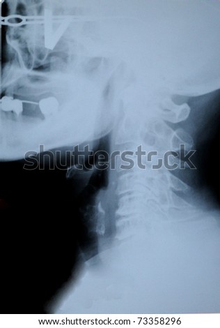 detail of neck and head x-ray