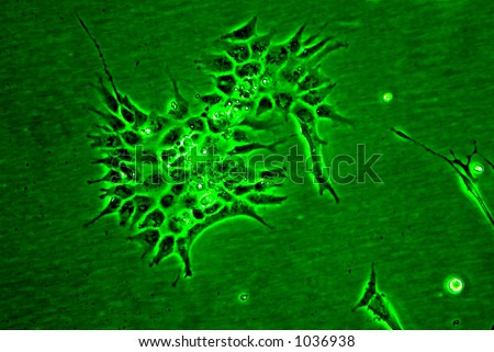 stock photo : Animal cells in culture viewed under an inverted microscope.