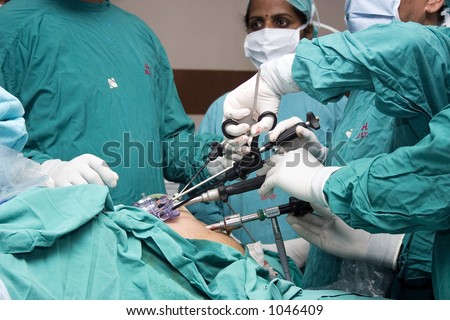 gallbladder surgery. gallbladder surgery scars.