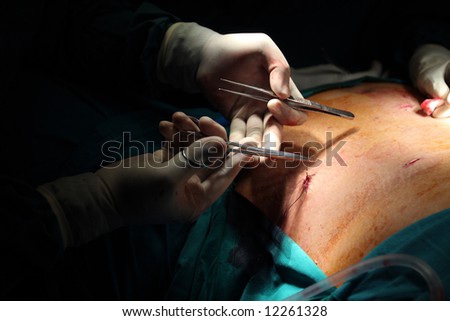 Surgery Surgeon Doctor Health Operation Theater Hands Stitch