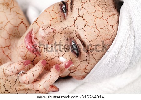 Woman applying moisturizing cream on her cracked skin