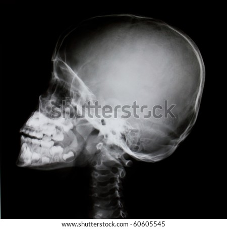 Image Of Neck