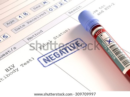Image concept with the result of the HIV test.