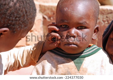 August 2014-Village of Pomerini - Tanzania- Africa-African children of the Franciscan Mission of Pomerini for humanitarian aid against AIDS while cleaning your face from dirt and scabs of the disease.