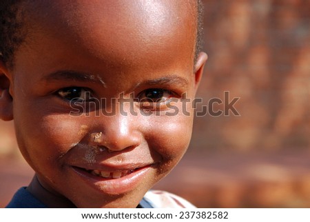 20 August, 2014-Pomerini-Tanzania-Africa-Unidentified African child sick of the virus AIDS, helped by the Friars of the Franciscan Mission to give him the necessary medicines, a smile and a possible future