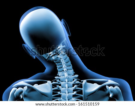 3D X-ray of painful neck 3D X-ray of painful neck