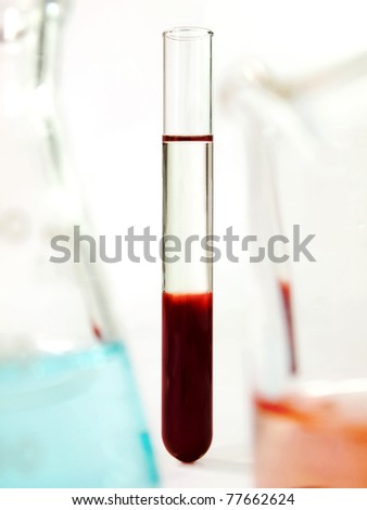 Blood and plasma in test tube, Experimental studies of Red Blood Cell (RBC) and Plasma in research laboratory